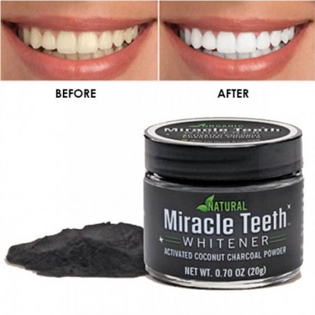 MIRACLE TEETH WHITENER - ΕΝΕΡΓΟΣ ΑΝΘΡΑΚΑΣ ΛΕΥΚΑΝΣΗΣ ΔΟΝΤΙΩΝ ΟΕΜ
