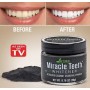 MIRACLE TEETH WHITENER - ΕΝΕΡΓΟΣ ΑΝΘΡΑΚΑΣ ΛΕΥΚΑΝΣΗΣ ΔΟΝΤΙΩΝ ΟΕΜ